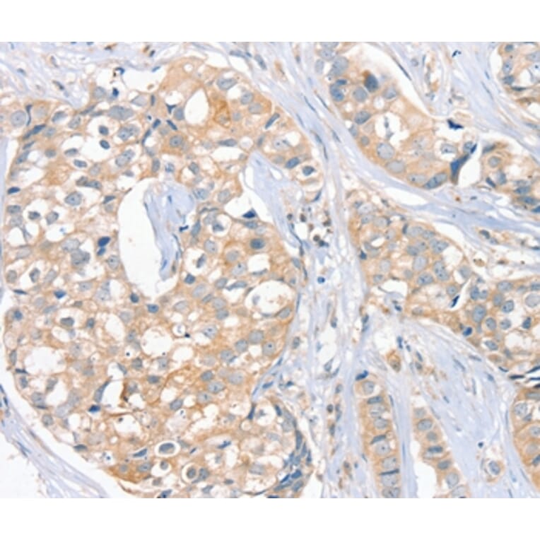 Immunohistochemistry - FAIM3 Antibody from Signalway Antibody (36458) - Antibodies.com