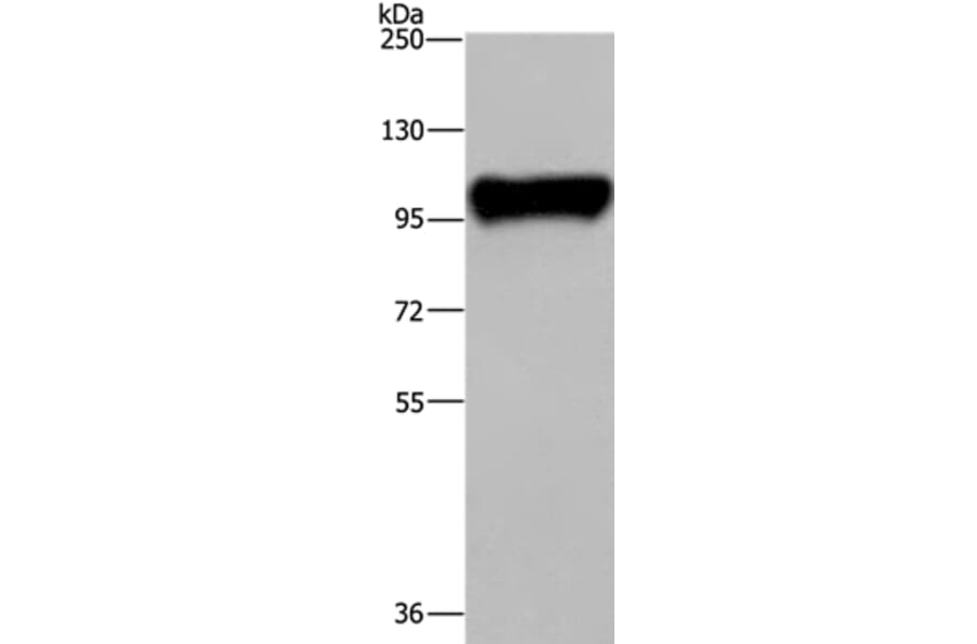 PTK2B Antibody from Signalway Antibody (36460) - Antibodies.com