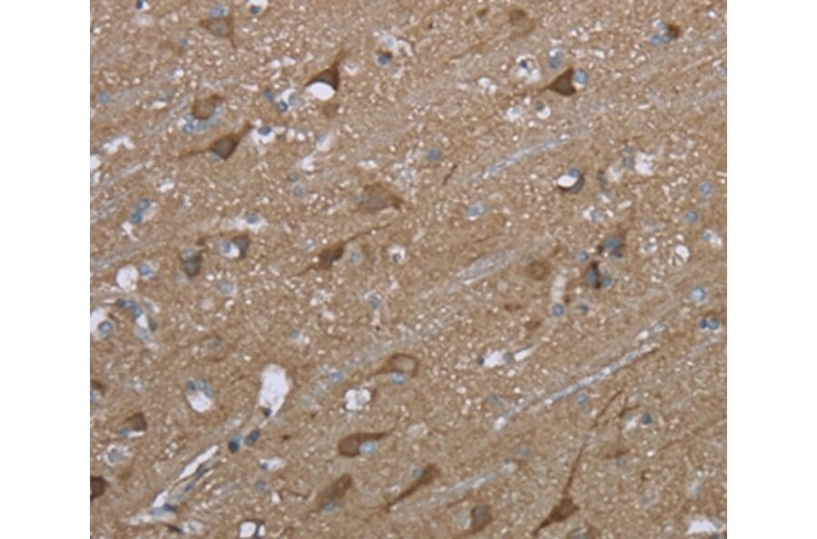 Immunohistochemistry - PTK2B Antibody from Signalway Antibody (36460) - Antibodies.com