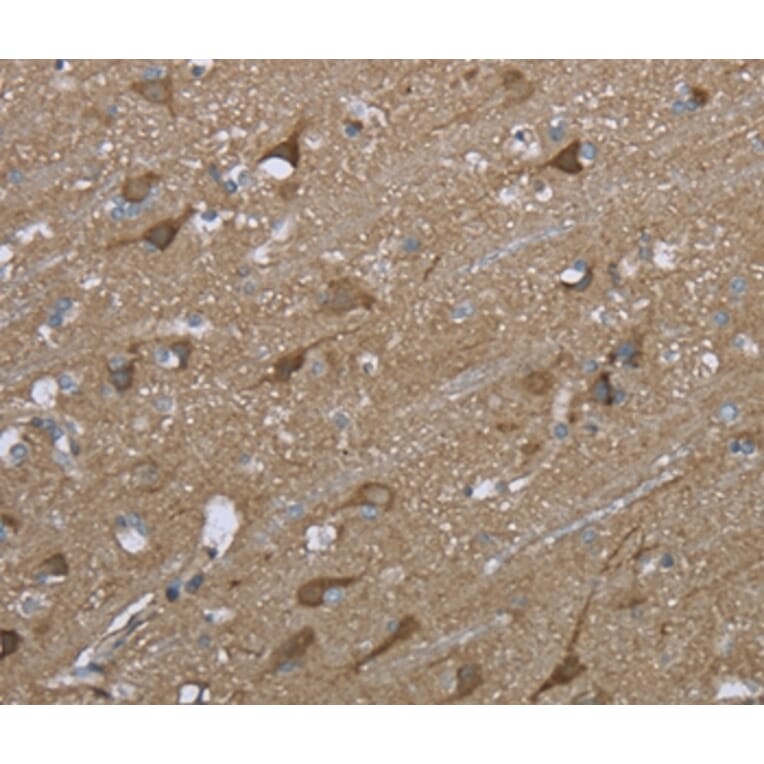 Immunohistochemistry - PTK2B Antibody from Signalway Antibody (36460) - Antibodies.com