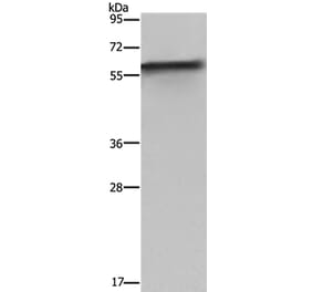 FKBP8 Antibody from Signalway Antibody (36485) - Antibodies.com