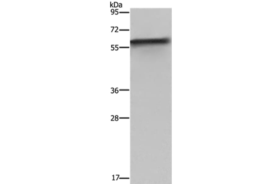 FKBP8 Antibody from Signalway Antibody (36485) - Antibodies.com