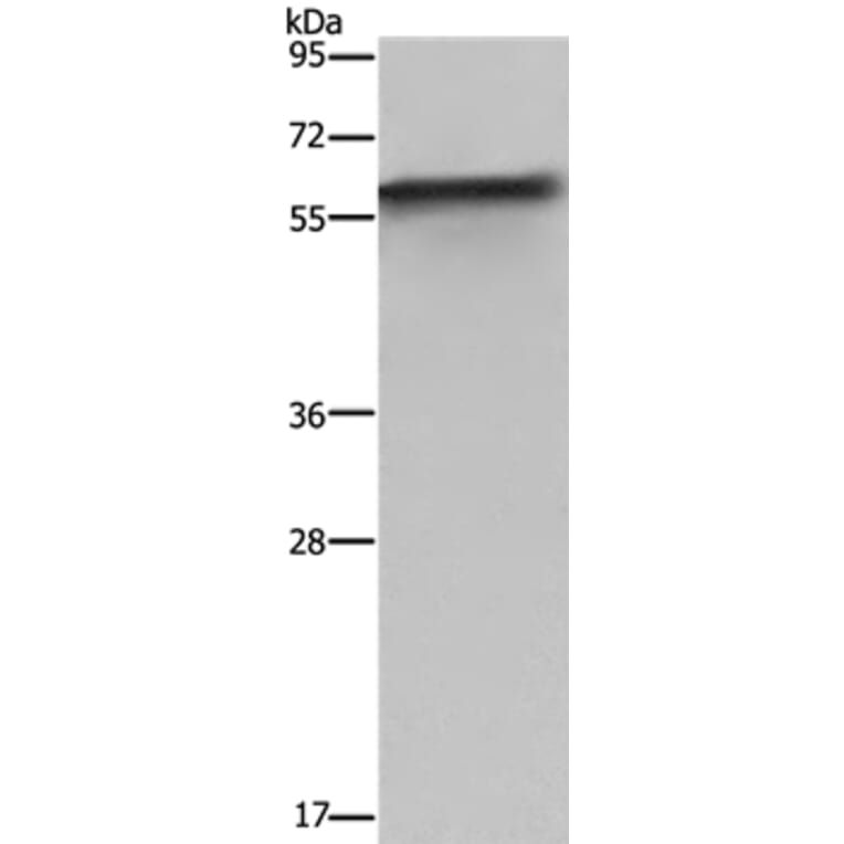 FKBP8 Antibody from Signalway Antibody (36485) - Antibodies.com