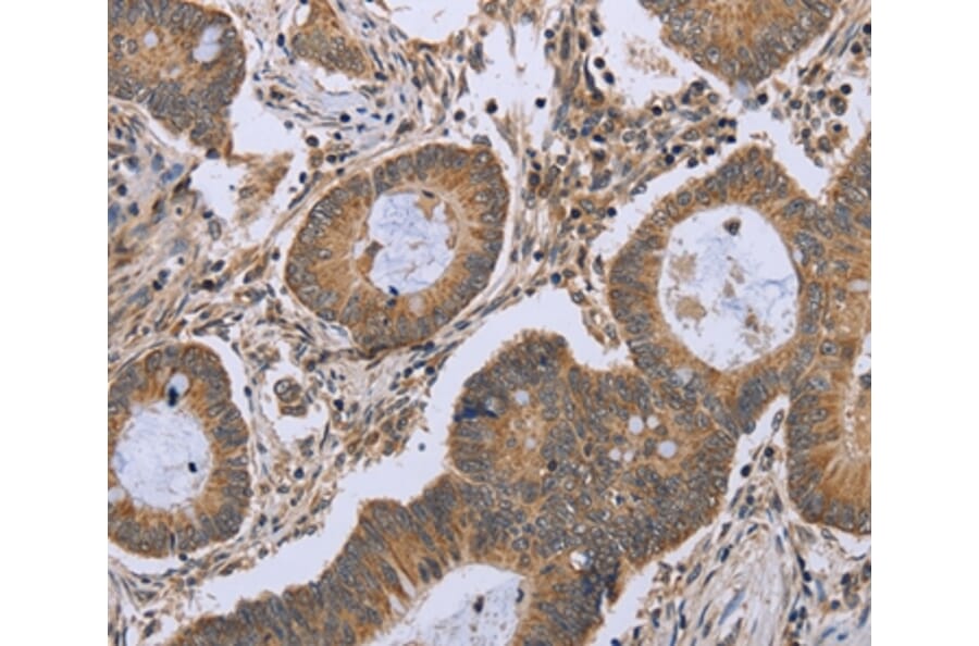 Immunohistochemistry - FKBP8 Antibody from Signalway Antibody (36485) - Antibodies.com