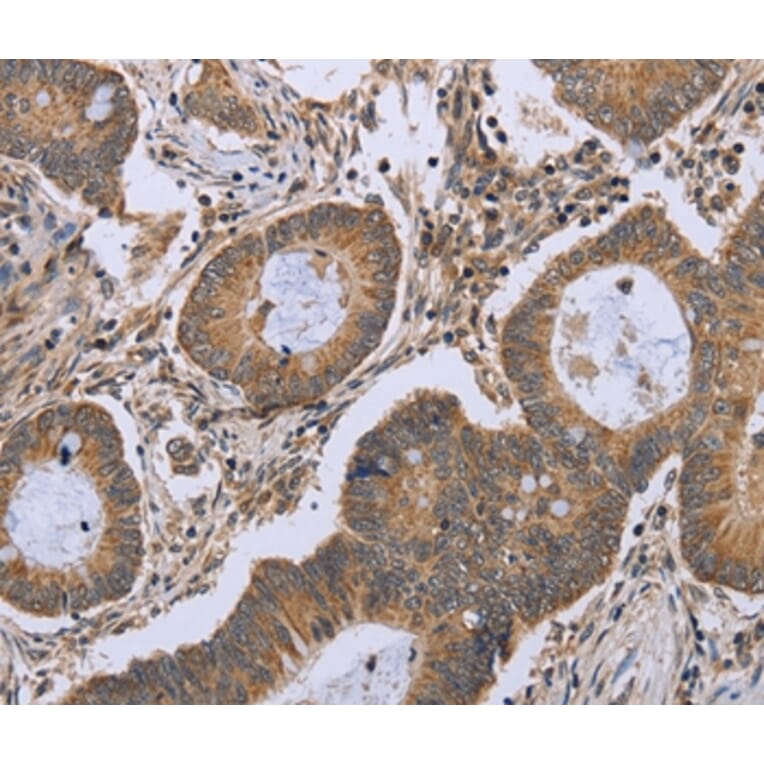 Immunohistochemistry - FKBP8 Antibody from Signalway Antibody (36485) - Antibodies.com