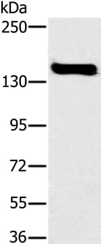 Gel: 6%SDS-PAGE Lysate: 40ug A172 cell Primary antibody: 1/300 dilution Secondary antibody dilution: 1/8000 Exposure time: 40 seconds