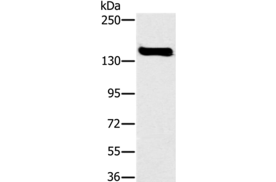 FMNL1 Antibody from Signalway Antibody (36487) - Antibodies.com