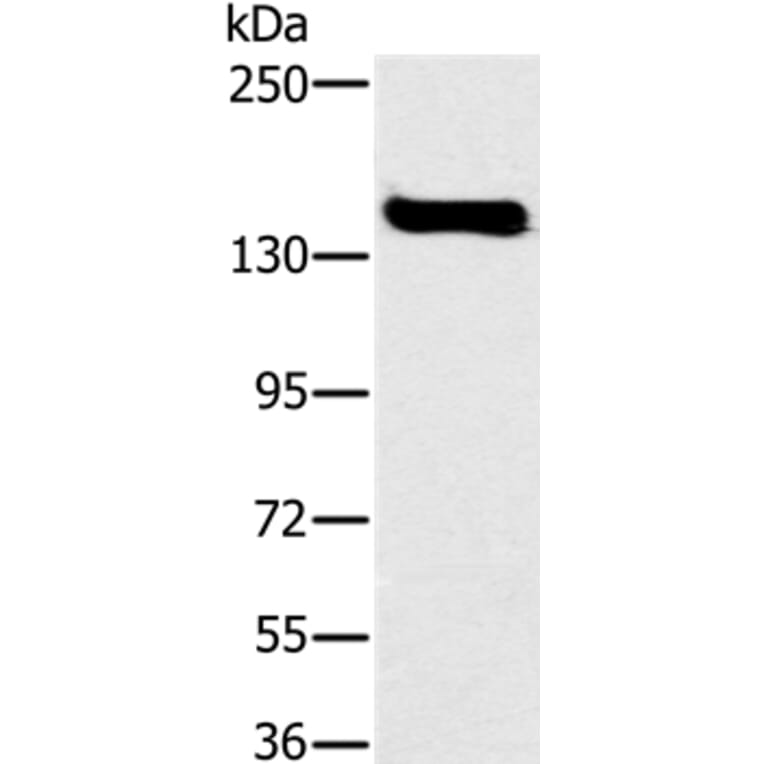 FMNL1 Antibody from Signalway Antibody (36487) - Antibodies.com