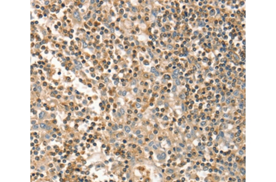 Immunohistochemistry - FMNL1 Antibody from Signalway Antibody (36487) - Antibodies.com