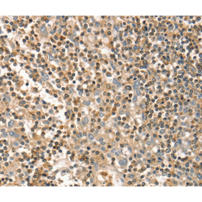Immunohistochemistry - FMNL1 Antibody from Signalway Antibody (36487) - Antibodies.com