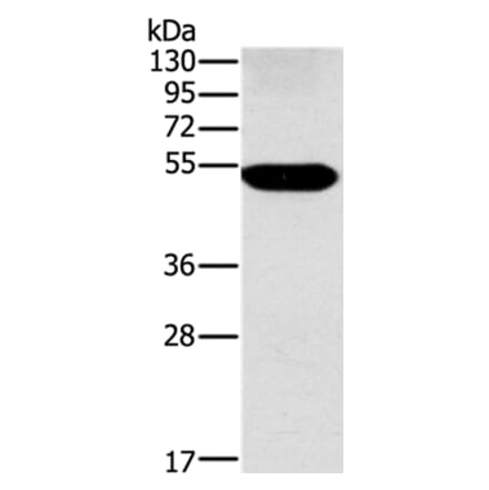 FUCA1 Antibody from Signalway Antibody (36490) - Antibodies.com