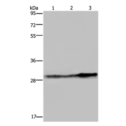 GSTO1 Antibody from Signalway Antibody (36514) - Antibodies.com
