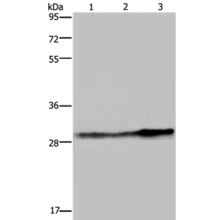 GSTO1 Antibody from Signalway Antibody (36514) - Antibodies.com