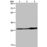 GSTO1 Antibody from Signalway Antibody (36514) - Antibodies.com