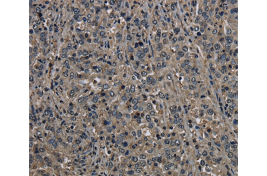 Immunohistochemistry - GSTO1 Antibody from Signalway Antibody (36514) - Antibodies.com