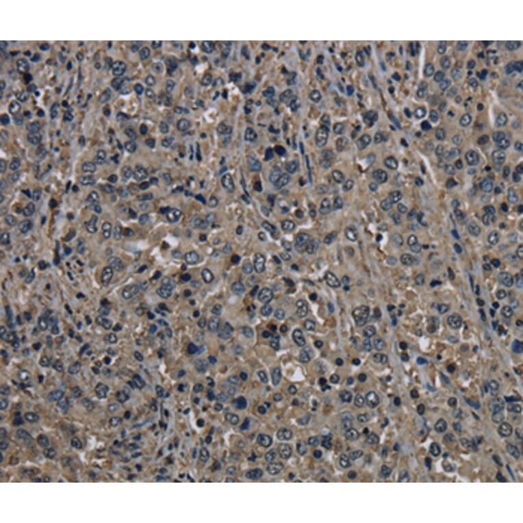 Immunohistochemistry - GSTO1 Antibody from Signalway Antibody (36514) - Antibodies.com