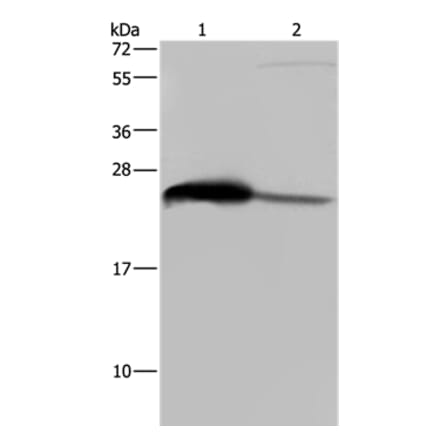 GSTA3 Antibody from Signalway Antibody (36515) - Antibodies.com