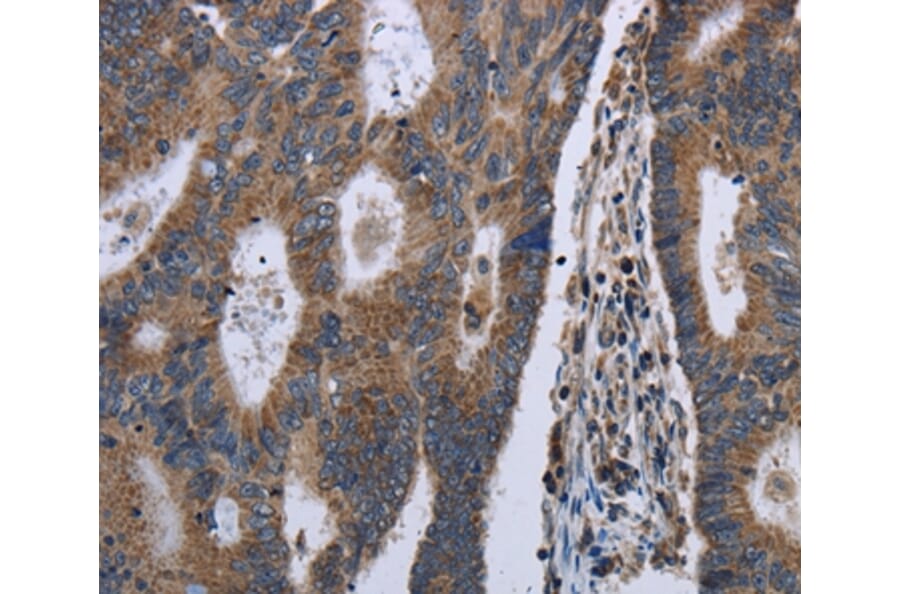 Immunohistochemistry - GSTA3 Antibody from Signalway Antibody (36515) - Antibodies.com