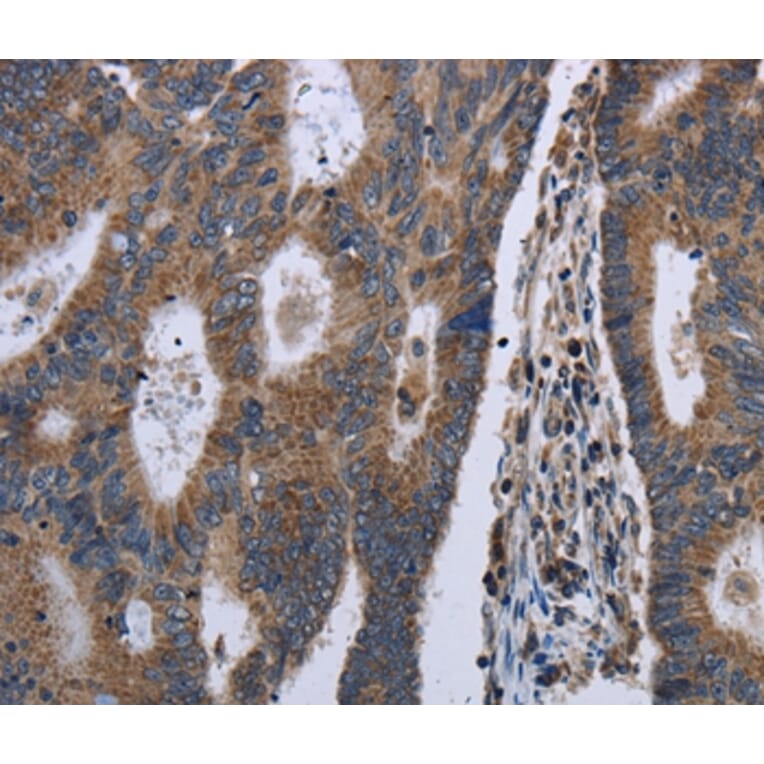 Immunohistochemistry - GSTA3 Antibody from Signalway Antibody (36515) - Antibodies.com