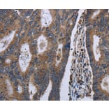 Immunohistochemistry - GSTA3 Antibody from Signalway Antibody (36515) - Antibodies.com