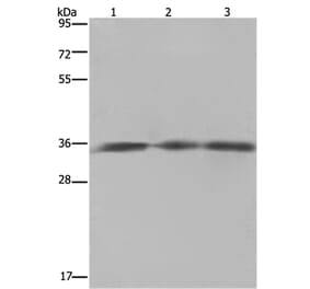 HMGCL Antibody from Signalway Antibody (36521) - Antibodies.com