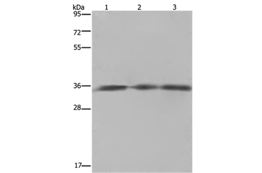 HMGCL Antibody from Signalway Antibody (36521) - Antibodies.com