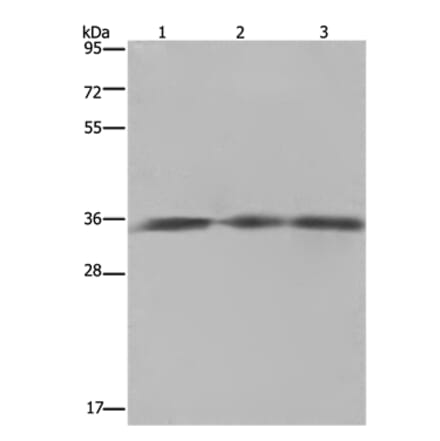 HMGCL Antibody from Signalway Antibody (36521) - Antibodies.com