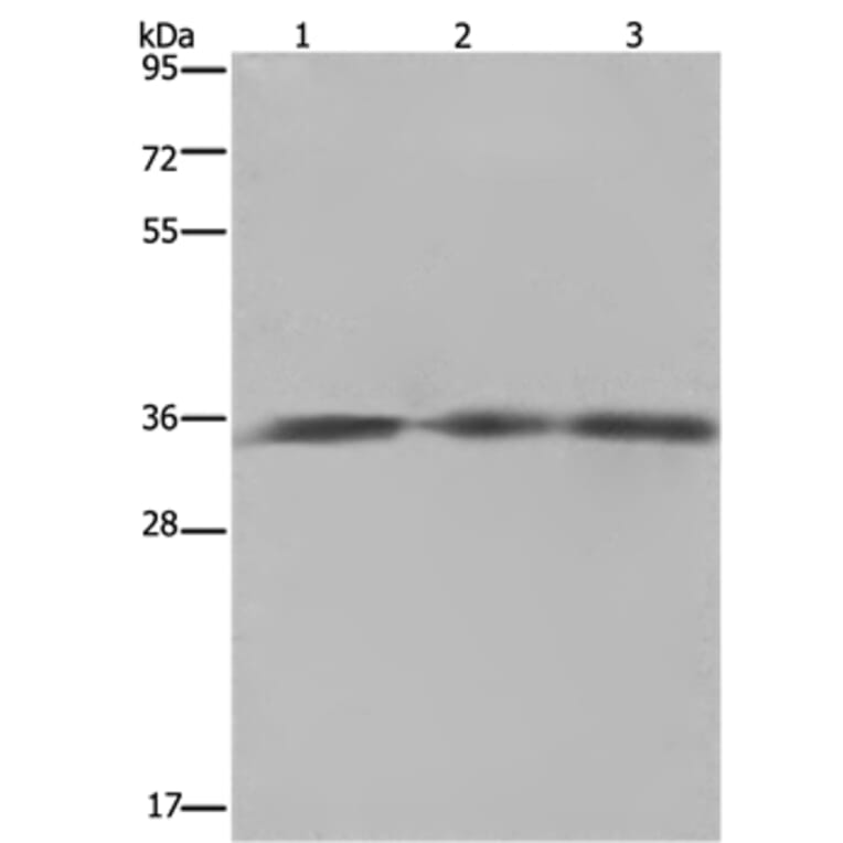 HMGCL Antibody from Signalway Antibody (36521) - Antibodies.com