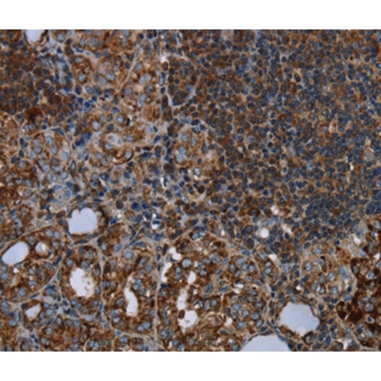 Immunohistochemistry - HMGCL Antibody from Signalway Antibody (36521) - Antibodies.com