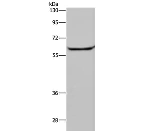 HACL1 Antibody from Signalway Antibody (36525) - Antibodies.com