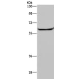 HACL1 Antibody from Signalway Antibody (36525) - Antibodies.com