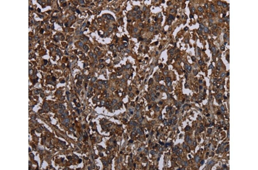 Immunohistochemistry - HACL1 Antibody from Signalway Antibody (36525) - Antibodies.com
