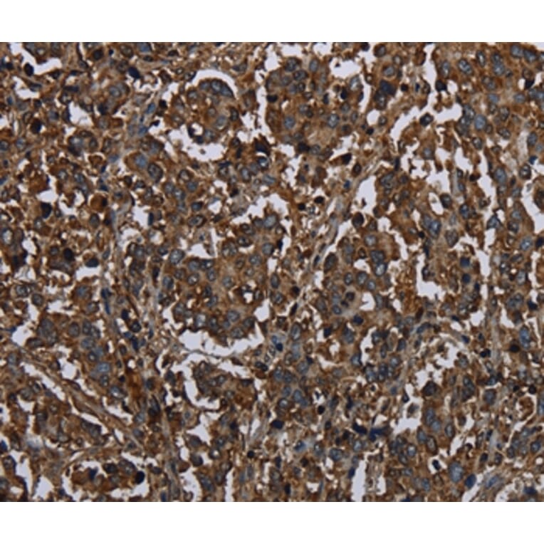Immunohistochemistry - HACL1 Antibody from Signalway Antibody (36525) - Antibodies.com