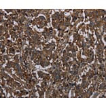 Immunohistochemistry - HACL1 Antibody from Signalway Antibody (36525) - Antibodies.com