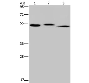 HYAL3 Antibody from Signalway Antibody (36540) - Antibodies.com