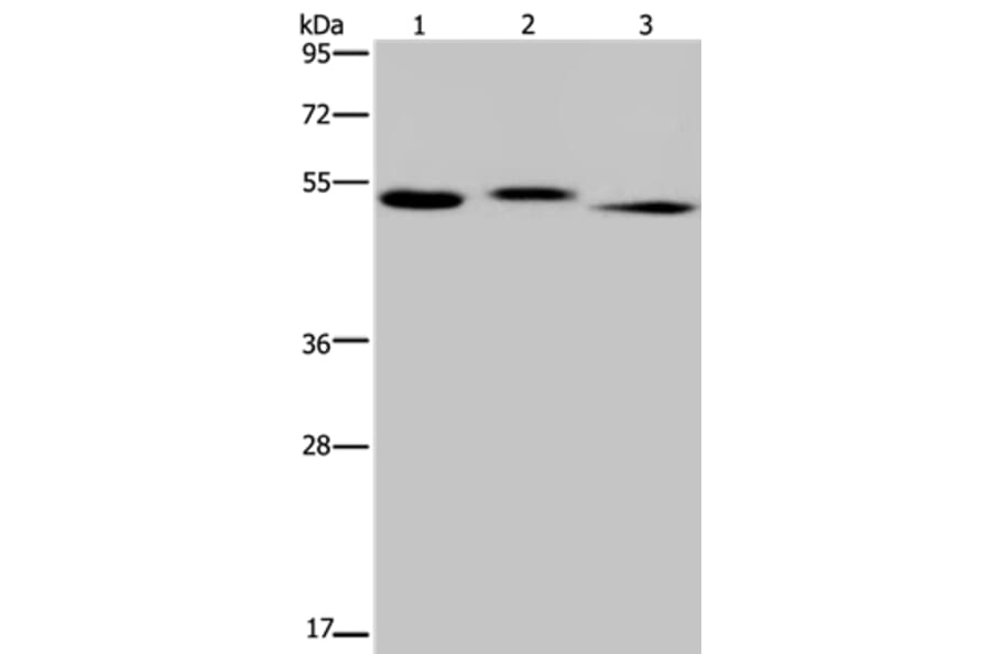 HYAL3 Antibody from Signalway Antibody (36540) - Antibodies.com
