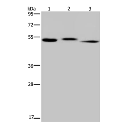 HYAL3 Antibody from Signalway Antibody (36540) - Antibodies.com