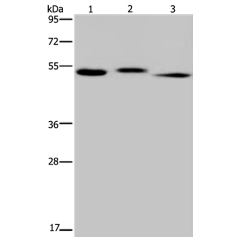 HYAL3 Antibody from Signalway Antibody (36540) - Antibodies.com