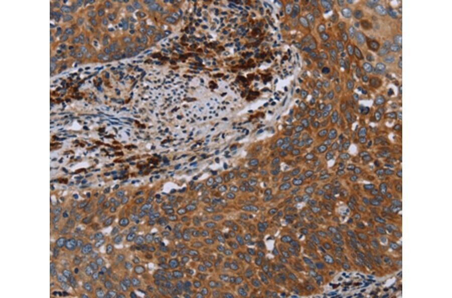 Immunohistochemistry - HYAL3 Antibody from Signalway Antibody (36540) - Antibodies.com