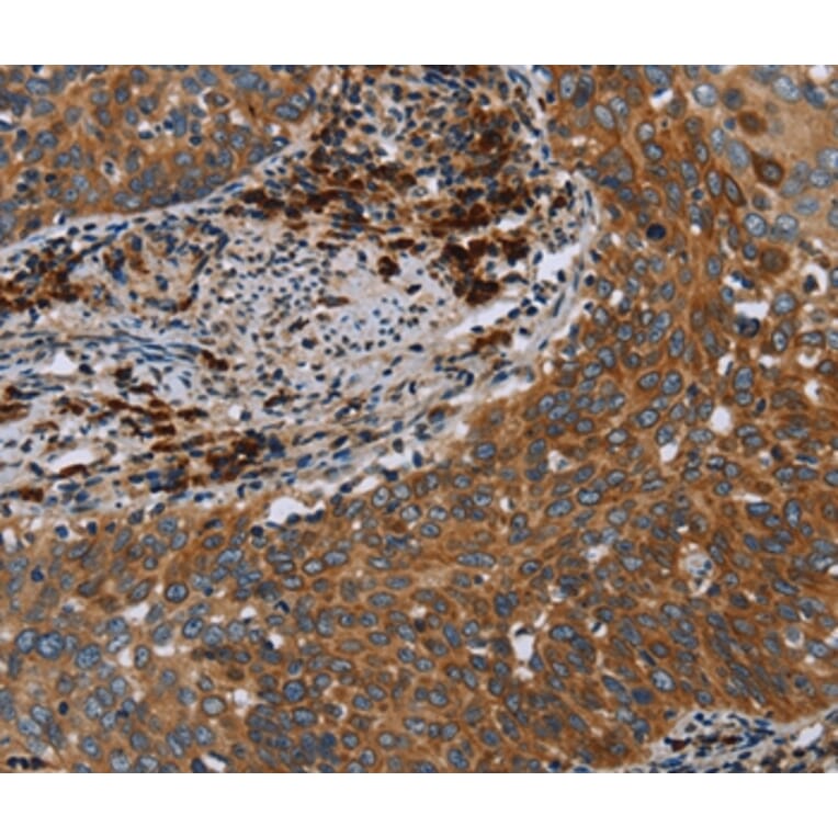 Immunohistochemistry - HYAL3 Antibody from Signalway Antibody (36540) - Antibodies.com