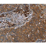 Immunohistochemistry - HYAL3 Antibody from Signalway Antibody (36540) - Antibodies.com