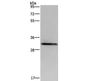 ICAM4 Antibody from Signalway Antibody (36543) - Antibodies.com
