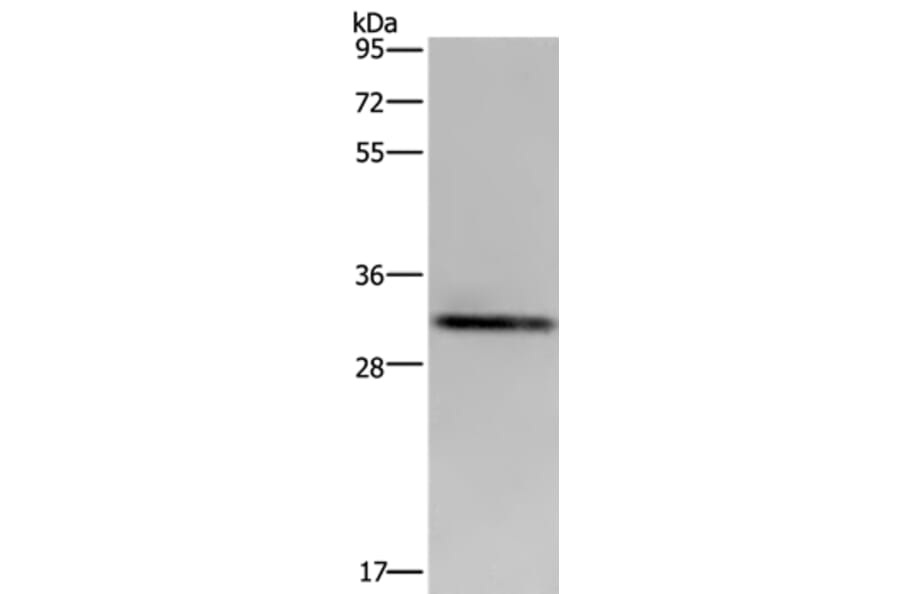 ICAM4 Antibody from Signalway Antibody (36543) - Antibodies.com