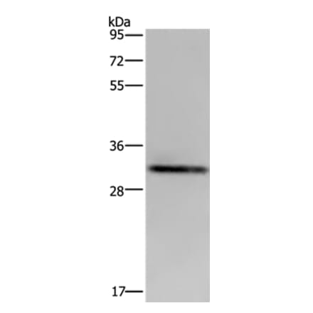 ICAM4 Antibody from Signalway Antibody (36543) - Antibodies.com