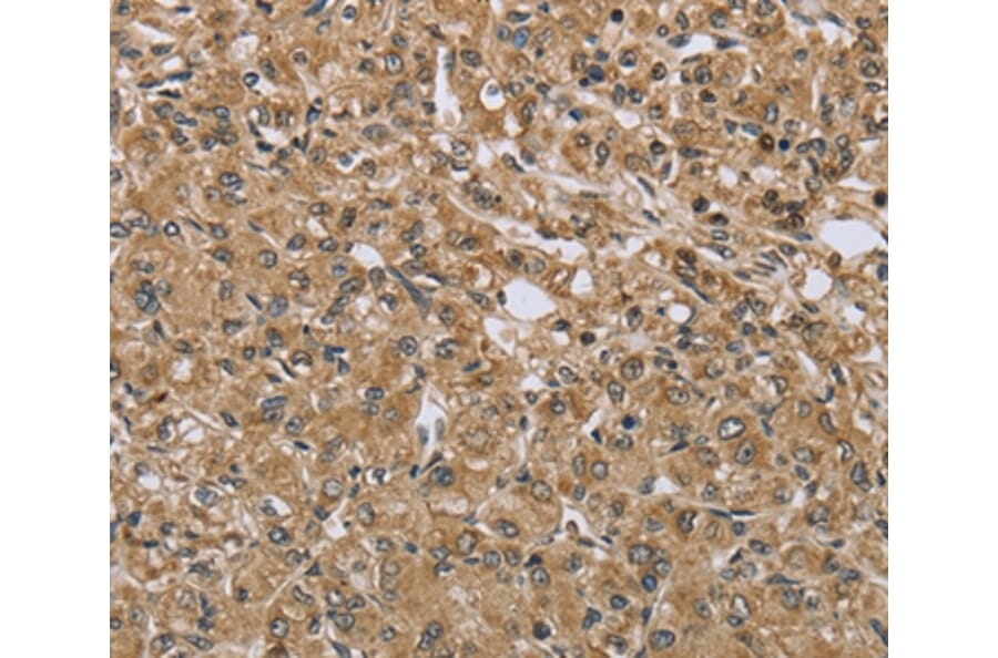 Immunohistochemistry - TXLNA Antibody from Signalway Antibody (36551) - Antibodies.com