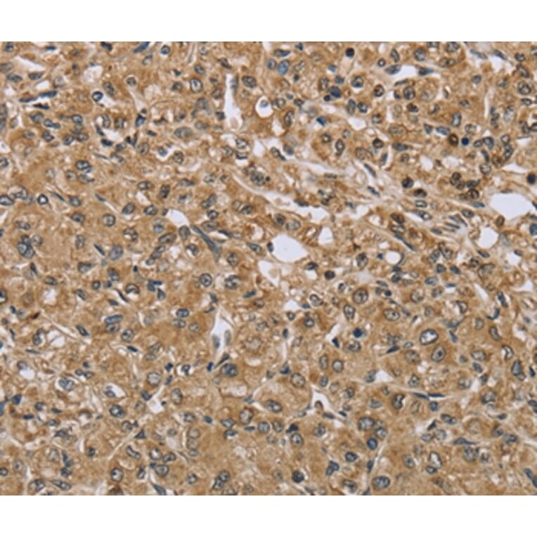 Immunohistochemistry - TXLNA Antibody from Signalway Antibody (36551) - Antibodies.com