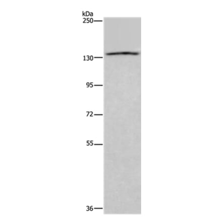 ITGAE Antibody from Signalway Antibody (36557) - Antibodies.com