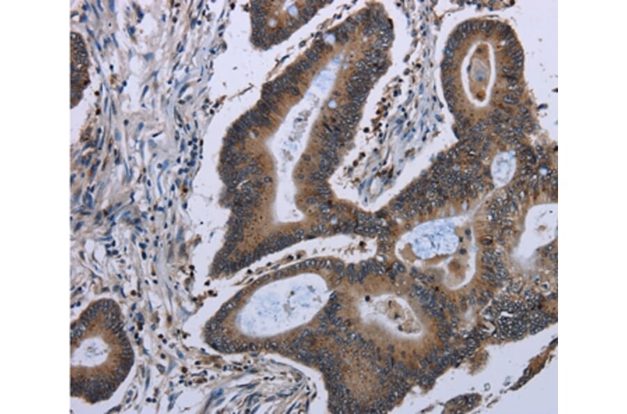 Immunohistochemistry - ITGAE Antibody from Signalway Antibody (36557) - Antibodies.com
