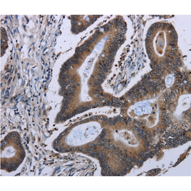 Immunohistochemistry - ITGAE Antibody from Signalway Antibody (36557) - Antibodies.com