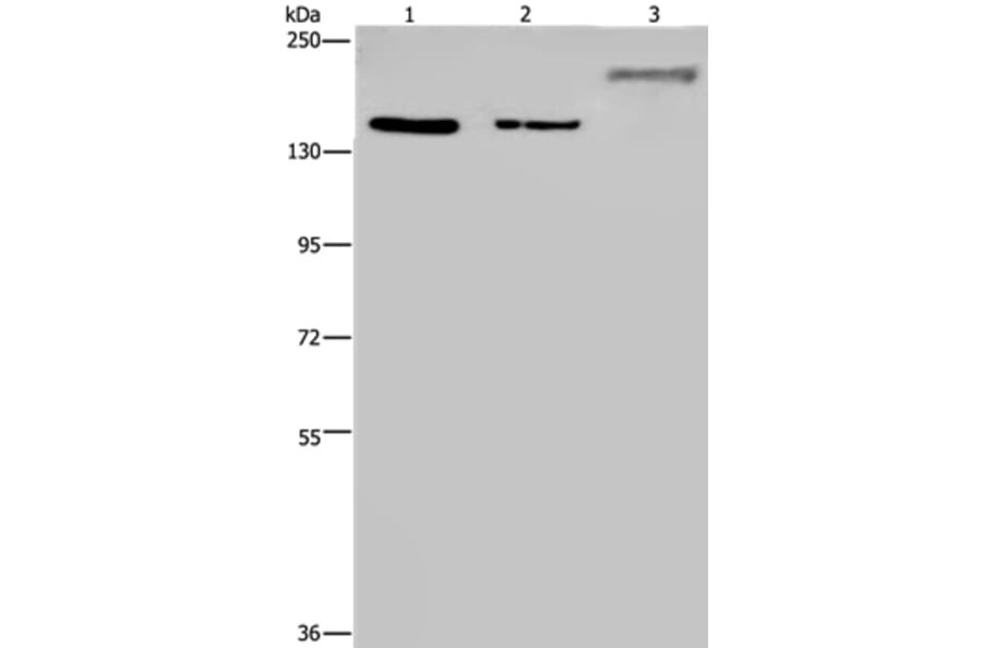 KDM3B Antibody from Signalway Antibody (36562) - Antibodies.com
